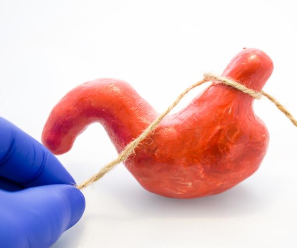 Bariatric Surgery